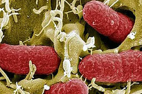 La bacteria 'E.coli' responsable de muerte de más de 20 personas en Alemania...