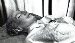Un estudio revela que Eva Perón fue sometida a una lobotomía poco antes de morir