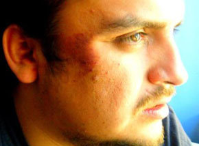 Testimonio de un estudiante chileno agredido por Carabineros 