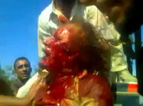 Gadafi fue ejecutado con un tiro a quemarropa en su cabeza