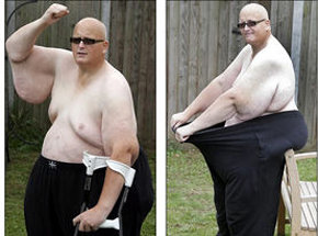 El hombre más gordo del mundo, todo piel tras perder 254 kilos