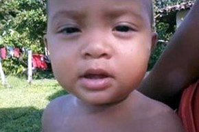 Kelvin Santos, un niño de 2 años de la localidad brasileña de Belem