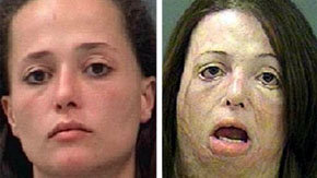 Antes y después de tomar drogas