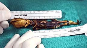 El ‘mini extraterrestre’ hallado en Chile tiene ADN humano