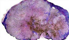 Una científica uruguaya descubre cómo frenar la mestástasis de forma natural