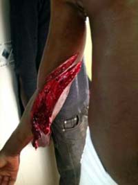 Uno de los inmigrantes ha sufrido graves heridas en un brazo 