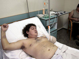 Franss Rilles, el trabajador boliviano indocumentado que perdió un brazo en un accidente laboral.
