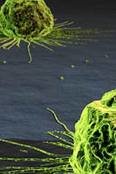 Células madre aliadas con un antiácido en lucha contra el cáncer