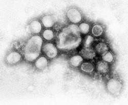 Fotografía del virus H1N1 tipo A, causante de la pandemia que en estos momentos recorre el mundo.