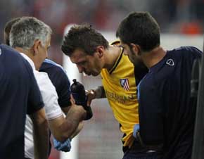 Mandzukic baja dos semanas por fractura nasal