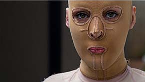 Mujer quemada se retira máscara y muestra su nuevo rostro