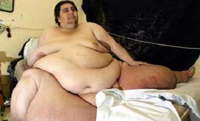 Las 10 personas más obesas de la historia