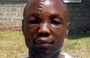 Así quedó el rostro de Omari Nyaega después de recibir un machetazo cuando trataba de defender a niños huérfanos.