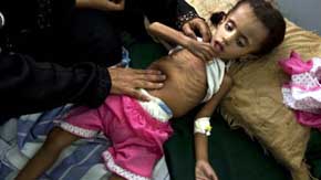 Seis niños mueren o resultan heridos cada día en la guerra de Yemen