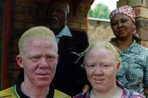 Continúan los asesinatos de albinos en Malaui
