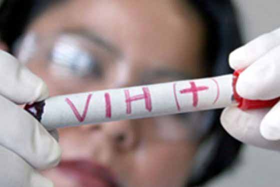 Los contagios de VIH en Chile subieron 68,7% en los últimos 10 años