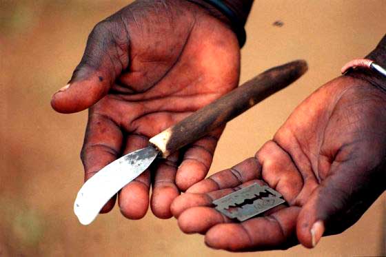 El rudimentario 'instrumental' conque se practica este bárbaro ritual en muchos países, especialmente de Afríca