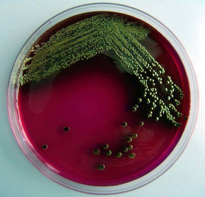 Detectan una súperbacteria E.Coli resistente a dos antibióticos