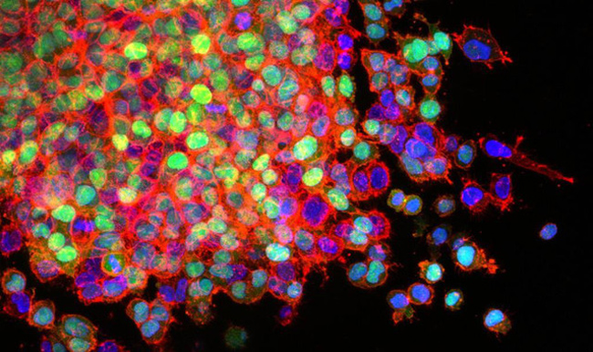 La técnica CRISPR de edición de ADN se prueba por primera vez en humanos