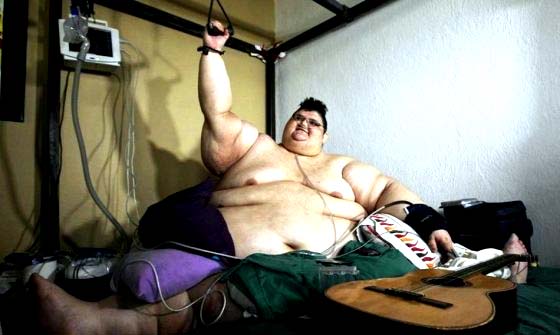 El hombre más obeso del mundo pesa 590 kilos