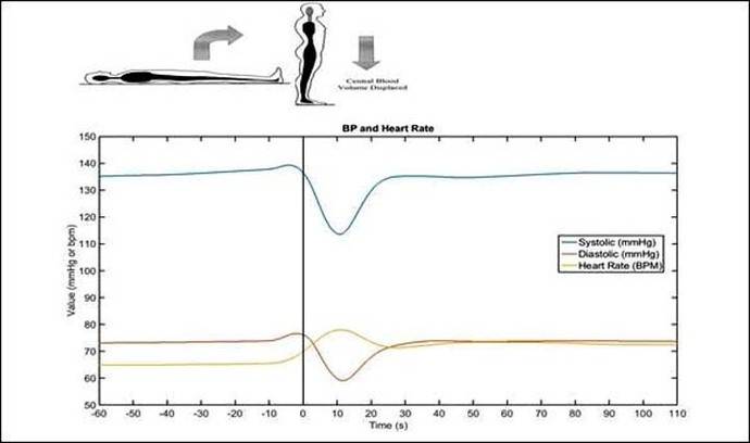 Heart Rate and Blood Pressure Response to Standing among 4475 Participants in the Irish Longitudinal Study on Ageing (TILDA)