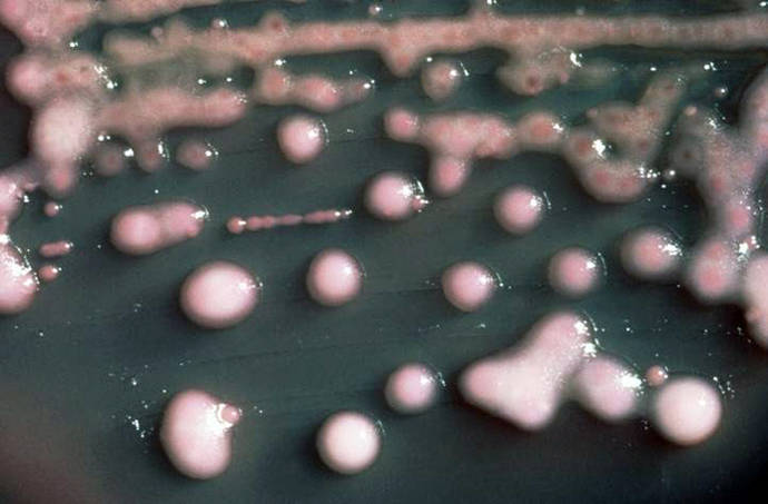 Imagen de la bacteria Klebsiella pneumoniae/ Wikipedia