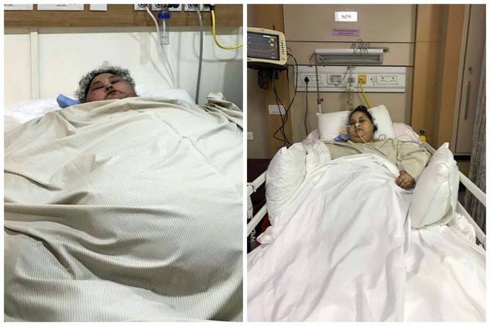 Eman Ahmed Abd El Aty, antes y después de la cirugía