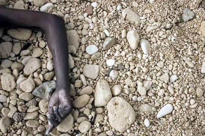 El brazo de un migrante que murió en su tránsito por el Mediterráneo. 