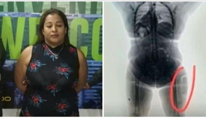 Colombia: Mujer quiso traficar casi un kilo de cocaína líquida dentro de sus muslos