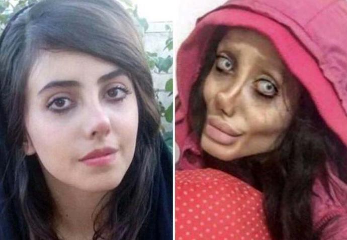 El rostro de Sahar Tabar antes y después de las cirugías plásticas