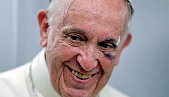 El papa Francisco bromeó sobre el golpe que sufrió en Cartagena de Indias, 