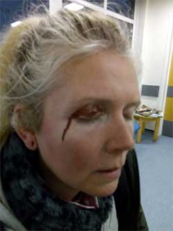 Un cazador agredió brutalmente a una activista defensora de los animales