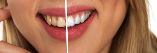 ¿Sabes por qué se oscurecen los dientes?