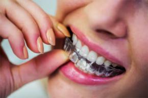 ¿Cómo encontrar un servicio de ortodoncia invisible fiable online?