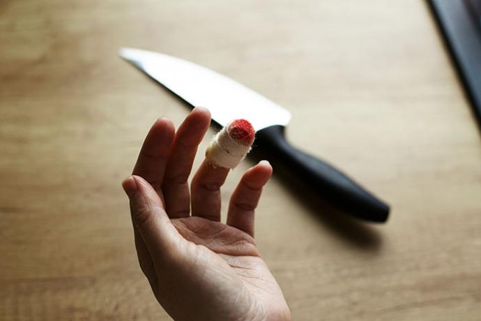 Cortarse con un cuchillo es muy frecuente