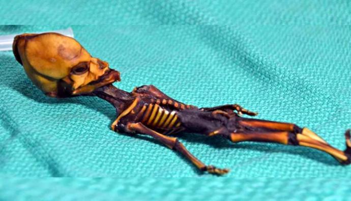 El 'Alien de Atacama' en realidad era un bebe con raras mutaciones