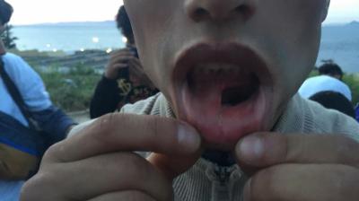 Mohammed muestra su labio roto después de que, según denuncia, la policía le golpease en una redada - Gabriela Sánchez