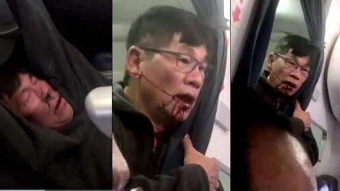 David Dao, el pasajero expulsado de United Airlines. (Foto: Captura)

