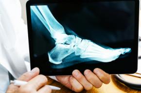 La ortopedia podal: solución y prevención