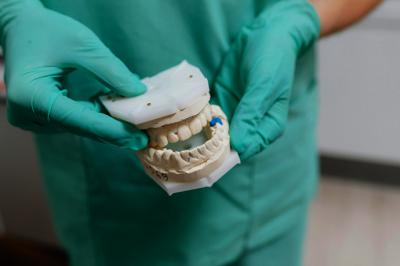 All on four: la técnica de implantología dental más revolucionaria