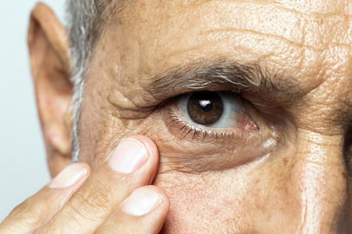 Degeneración Macular Asociada a la Edad, ¿es grave?