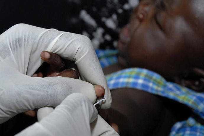 Entre 700.000 y 2.700.000 personas mueren al año por malaria, de los cuales más del 75% son niños en zonas endémicas de África