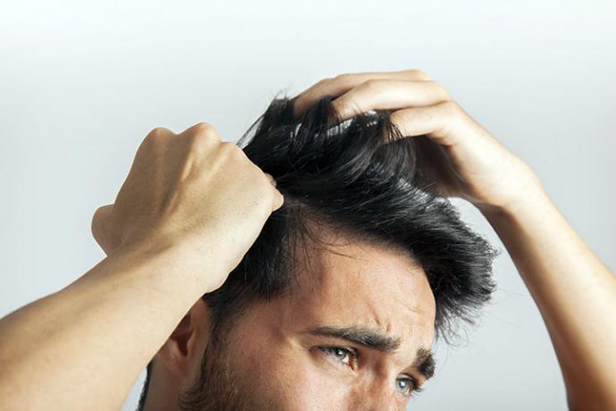 Minoxidil, el principio activo que sí frena la calvicie masculina