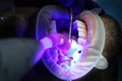 Descifrando el arte del blanqueamiento dental