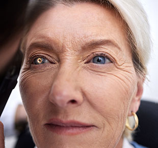 Glaucoma: qué es y cómo prevenir sus consecuencias