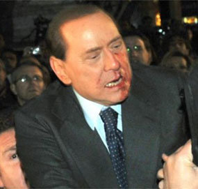 'Il Cavalieri' ha perdonado a su agresor